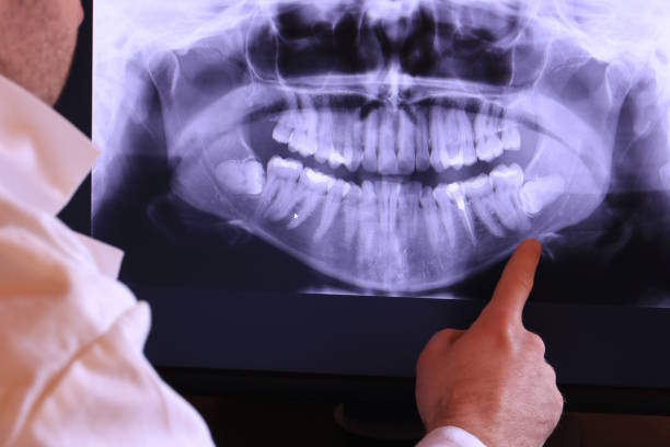Best Teeth Whitening  in Lincoln Center, KS