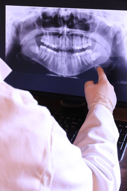 Best Knocked-Out Tooth Emergency  in Lincoln Center, KS