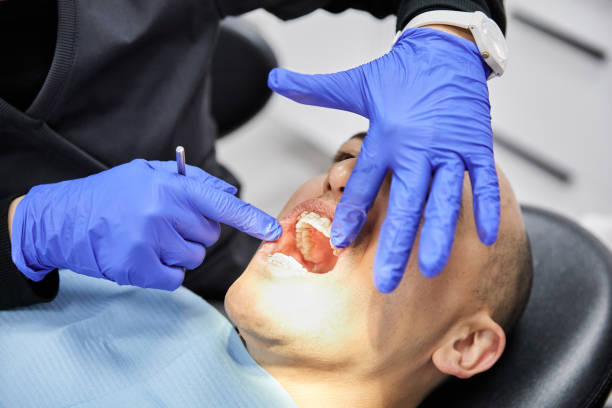 Best Broken Tooth Emergency  in Lincoln Center, KS